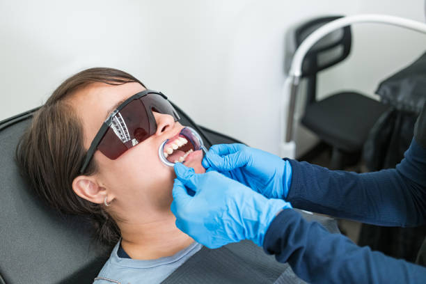 Best Knocked-Out Tooth (Avulsed Tooth) Treatment in Fern Park, FL